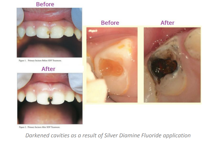 Dental Implants Periodontist